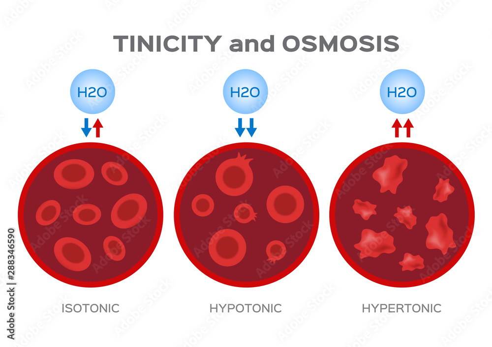 Isotonic Rbc blood and cell osmosis vector / isotonic hypotonic and hypertonic Stock ...
