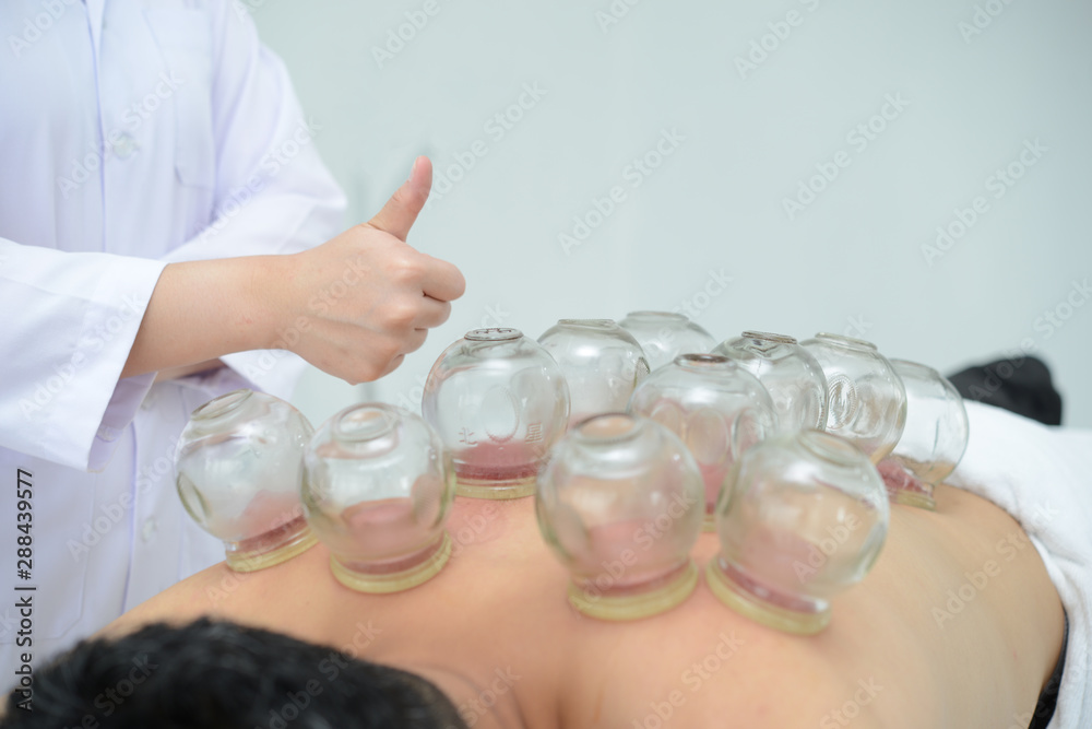 A Person Receiving Cupping Treatment On Back In Spa,Traditional Chinese Medicine Treatment. A Person Receiving Cupping Treatment On Back In Spa,Traditional Chinese Medicine Treatment.