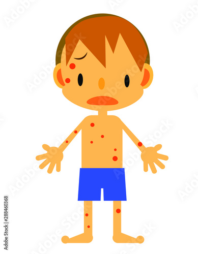 男の子　発疹