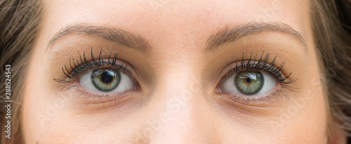 A closeup view on the green eyes of a pretty caucasian girl with one pupil larger than the other. A common condition called anisocoria affecting a fifth of the population.