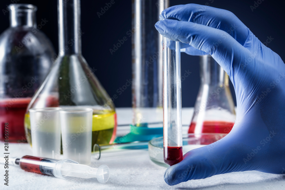 hand holding blood in test tube close up hand holding blood in test tube close up