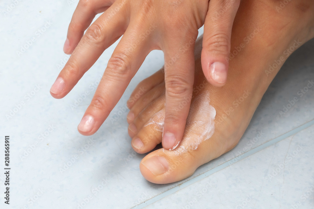 Naklejka premium A closeup view of a caucasian person massaging moisturizing cream into the top of the bare foot and toes, skin health and dermatology concept.