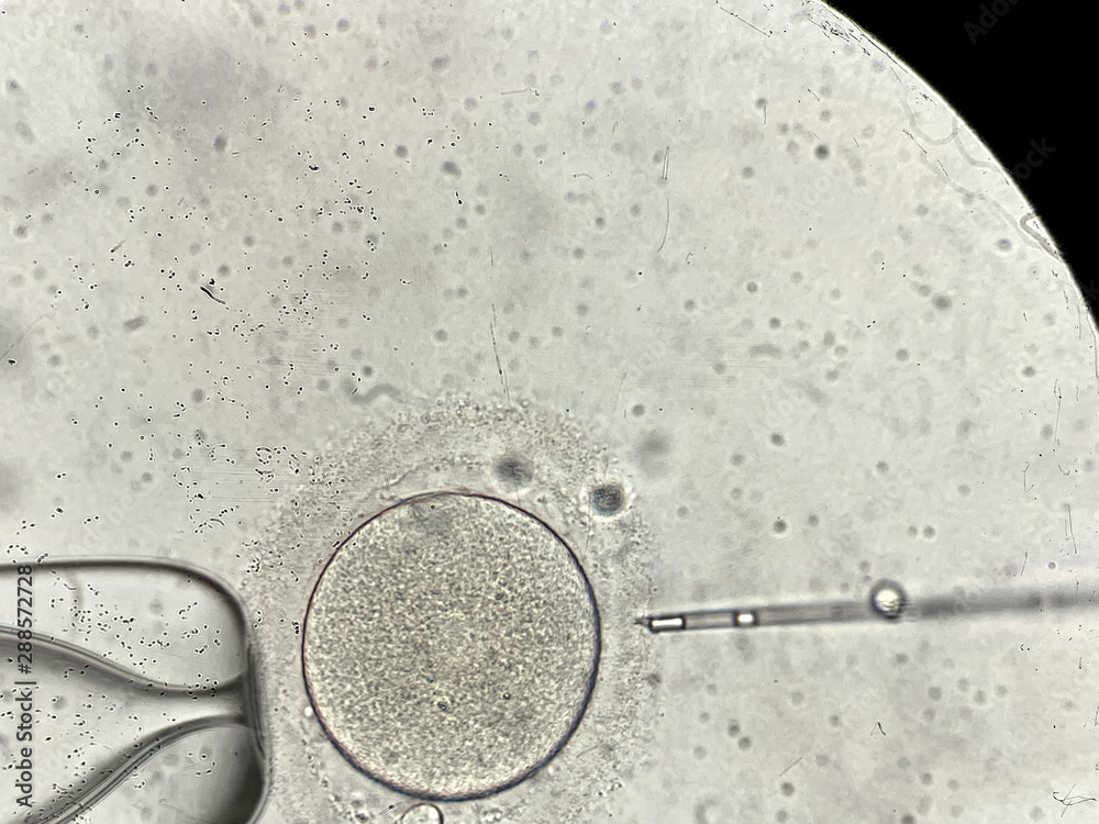 View through microscope at in vitro fertilization process Stock Photo ...