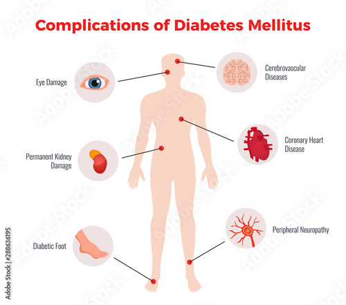 Diabetes Medical Poster 