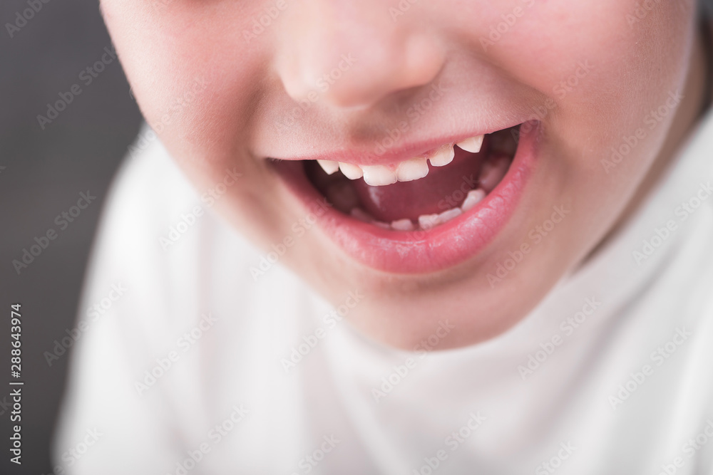 Closeup photo of boy mouth smiling