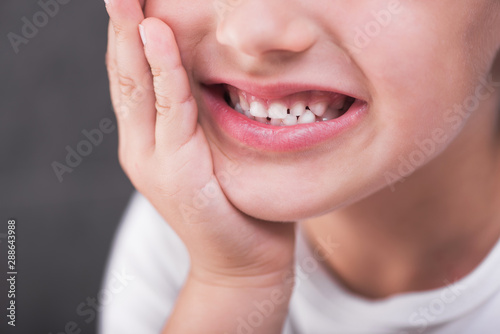 Closeup of children white teeth