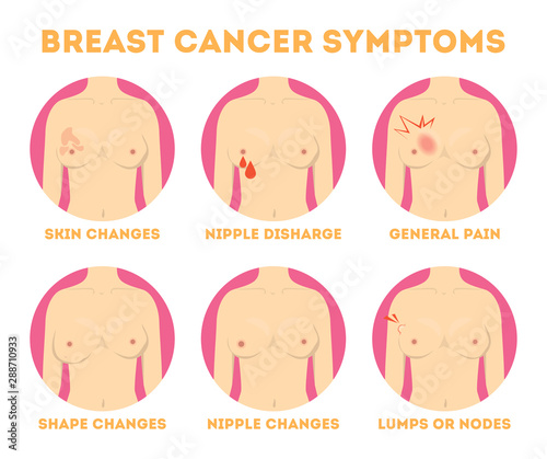 Breast cancer pink infographic for woman awareness.