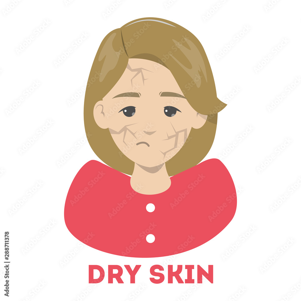 Woman with dry skin on the face. Facial problem