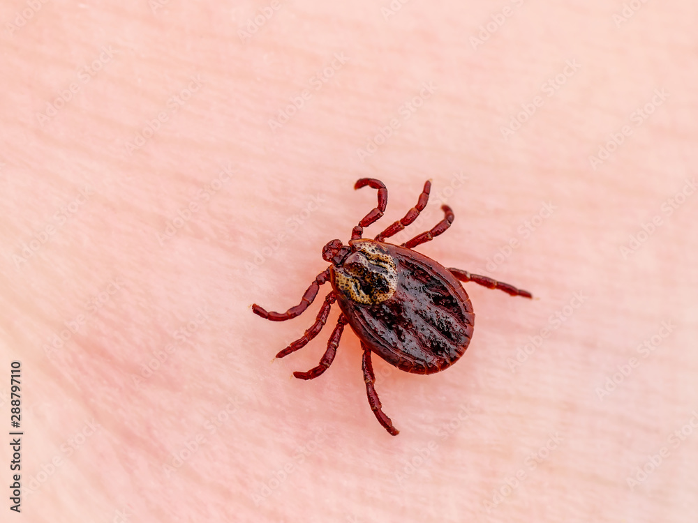 Encephalitis Virus or Lyme Borreliosis Disease Infectious Dermacentor Tick Arachnid Parasite Insect on Skin Macro Encephalitis Virus or Lyme Borreliosis Disease Infectious Dermacentor Tick Arachnid Parasite Insect on Skin Macro