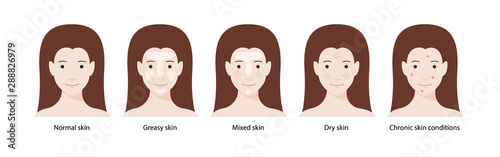Women`s types of skin: normal, greasy, mixed, dry skins and chronic skin conditions