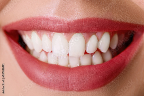 Closeup of smile with white healthy teeth.Teeth whitening. Dental care. Lips care