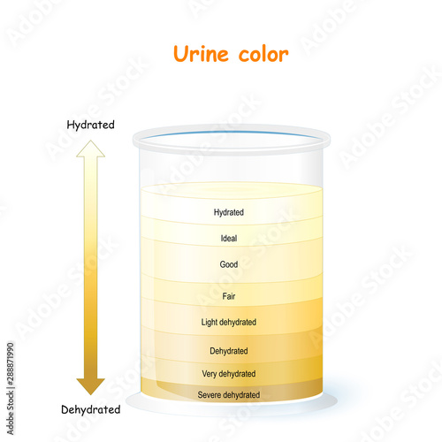 Urine Color Chart and Meaning. Assessing hydration