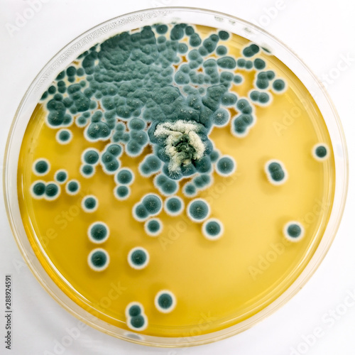 Penicillium sp. on Sabouraud's dextrose agar (SDA) incubated at 25 celsius 5 day