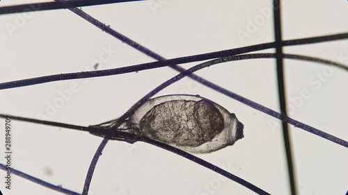 Lice egg attached to the hair, video taken with a high magnification microscope.	