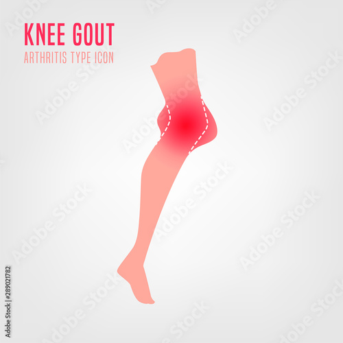 Gout arthritis icon