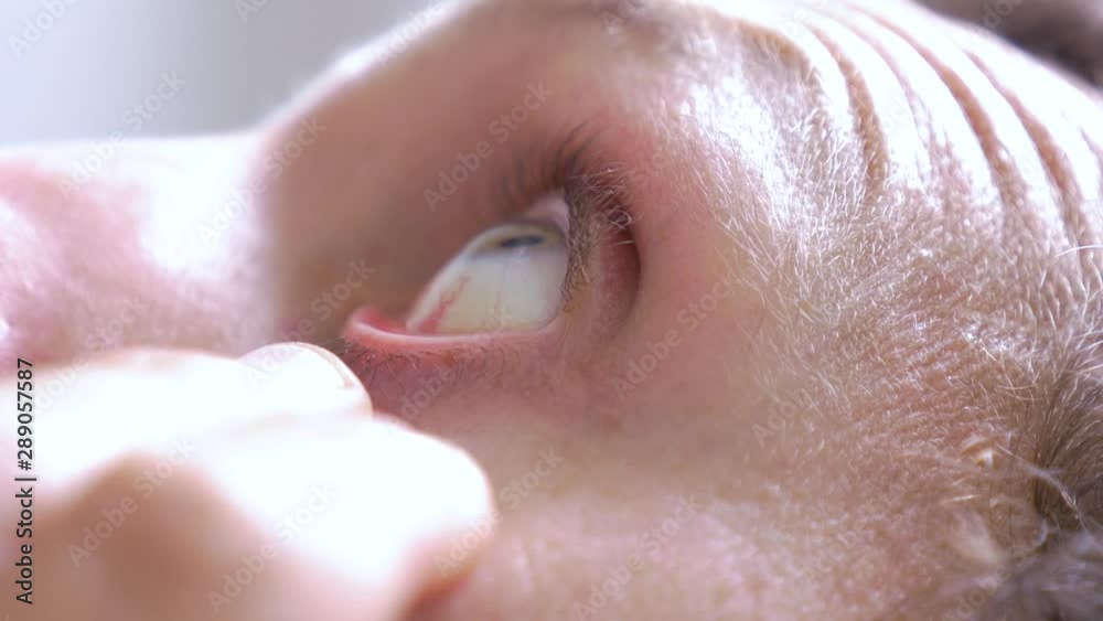 Macro Shot of a man putting eye drops to moisturize and relieve irritation in his Eye Macro Shot of a man putting eye drops to moisturize and relieve irritation in his Eye