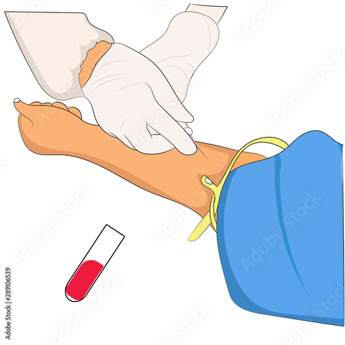 hand of nurse taking blood fro a vein for testing for hand girl vector illustrations