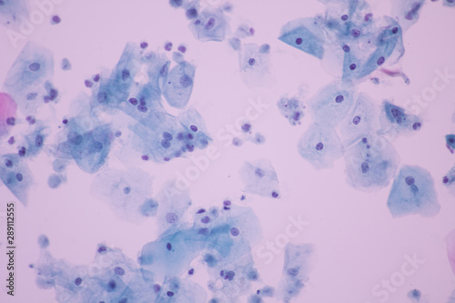 Trichomonas in pap smear on white background view in microscopic.Medical background.Cytology and pathology laboratory department.Sexually transmitted diseases.Magnification 600 X. photo