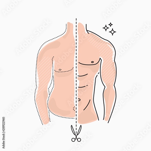 Body transformation. Weight loss concept. Before and after. Colorful vector illustration isolated on white background