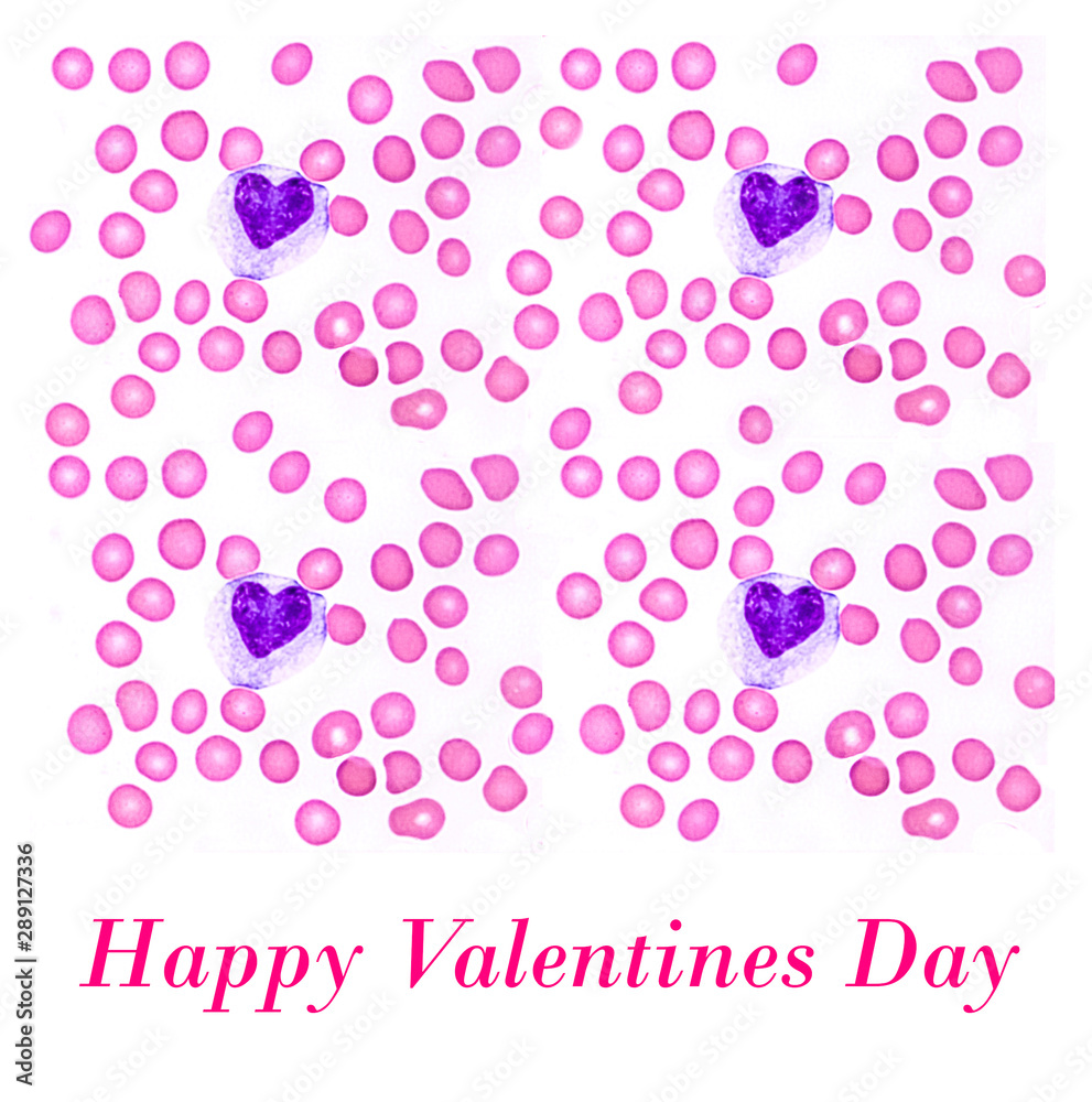 Happy Valentine's day greeting collage of an actual photograph of a peripheral blood smear showing a heart-shaped white blood cell.