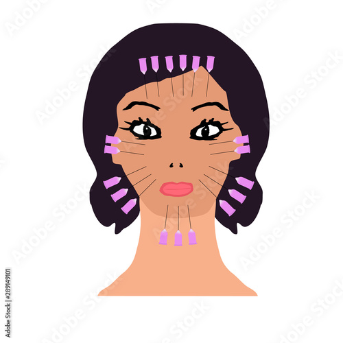 Thread lifting on the face. Threads for a facelift. Mesotherapy Wrinkles. Infographics. Vector illustration on isolated background.