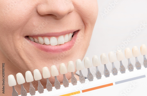 Woman smile with healthy teeth whitening
