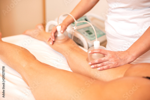 Masseuse applying vacuum cups for cellulite reduction