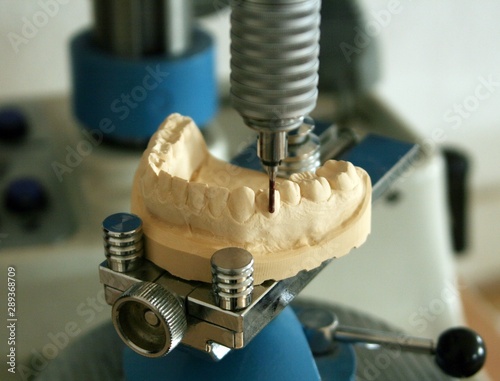 Zahntechnik, Modell Vermessung