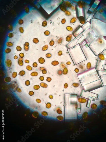 pink algae under the microscope photo