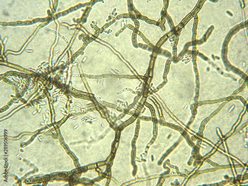 Valokuva Aureobasidium