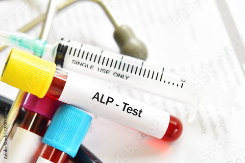 Blood sample tube for ALP or alkaline phosphatase enzyme test photo
