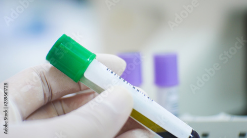 Fototapeta Naklejka Na Ścianę i Meble -  EDTA purple test tube compleate blood count test and lithium heparin green test tube for blood chemistry test.