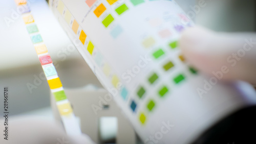 Urine strip test on blurred background.