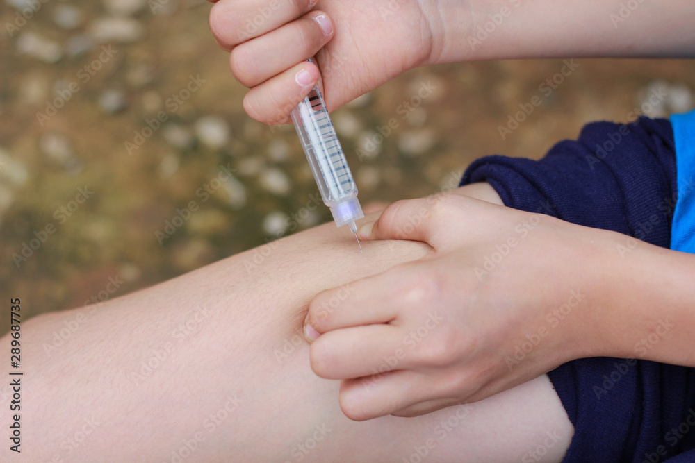 An Asian girl using insulin pen.Self insulin injection.Diabetes in children.
