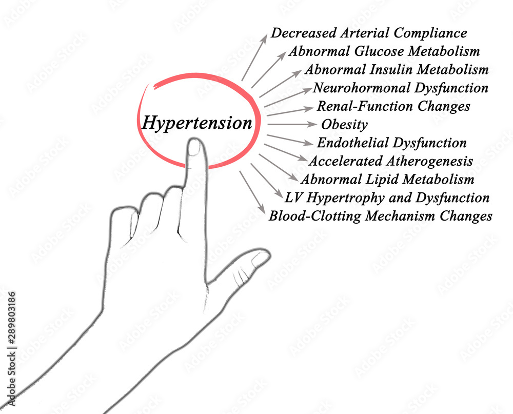 Eleven dangerous consequences of Hypertension Eleven dangerous consequences of Hypertension