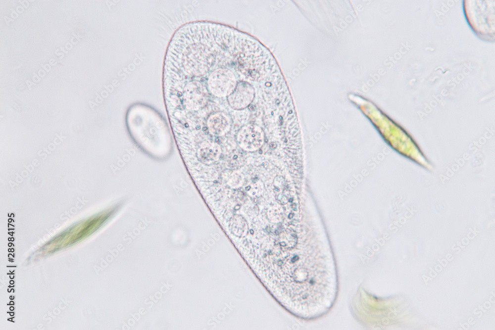 ciliates under microscope