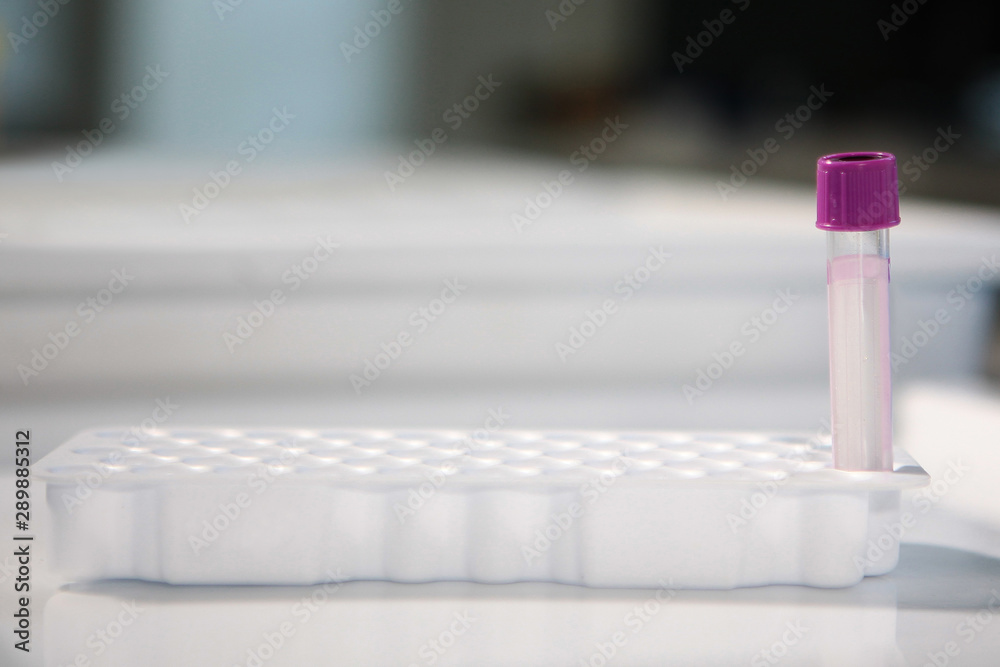 Empty test tube in a laboratory. The concept of laboratory work. Empty test tube in a laboratory. The concept of laboratory work.