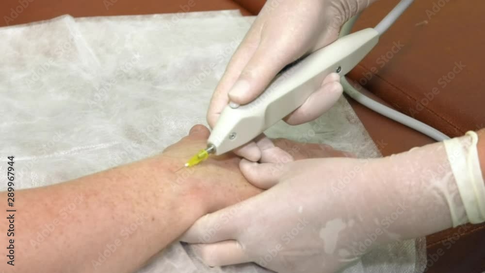 Reducing swelling of the joint. Ozone therapy joint chipping