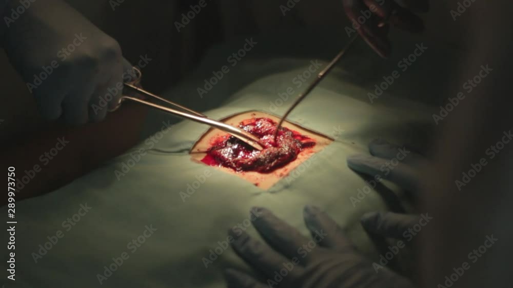 Emergency heart surgery in hospital Emergency heart surgery in hospital