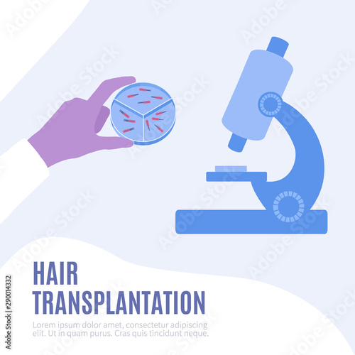 Hair transplantation laboratory. Doctor holding in his hand a petri dish with follicular units for scalp incision. Microscope for medical research. FUT and FUE alopecia treatment. Medical vector.