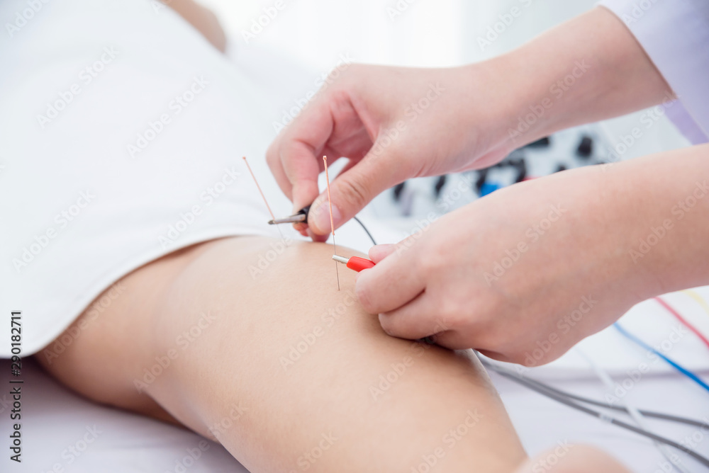 Close up of acupuncturist hands doing acupuncture with electrical stimulator at patient leg ,Alternative medicine concept. Close up of acupuncturist hands doing acupuncture with electrical stimulator at patient leg ,Alternative medicine concept.