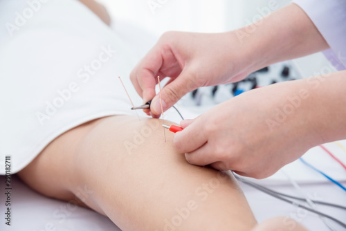 Close up of acupuncturist hands doing acupuncture with electrical stimulator at patient leg ,Alternative medicine concept.