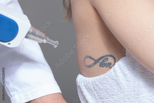  laser tattoo removal  in clinic closeup