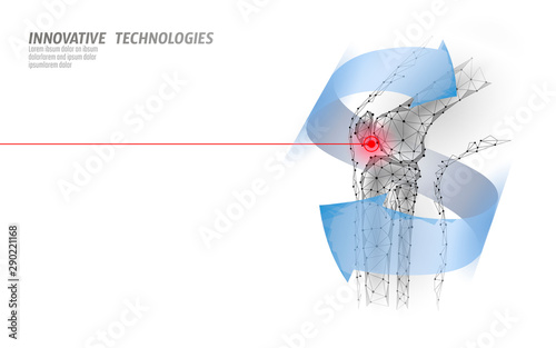 Human knee joint 3d model vector illustration. Low poly design future technology cure pain treatment. Blue background and red injury man body leg medicine template