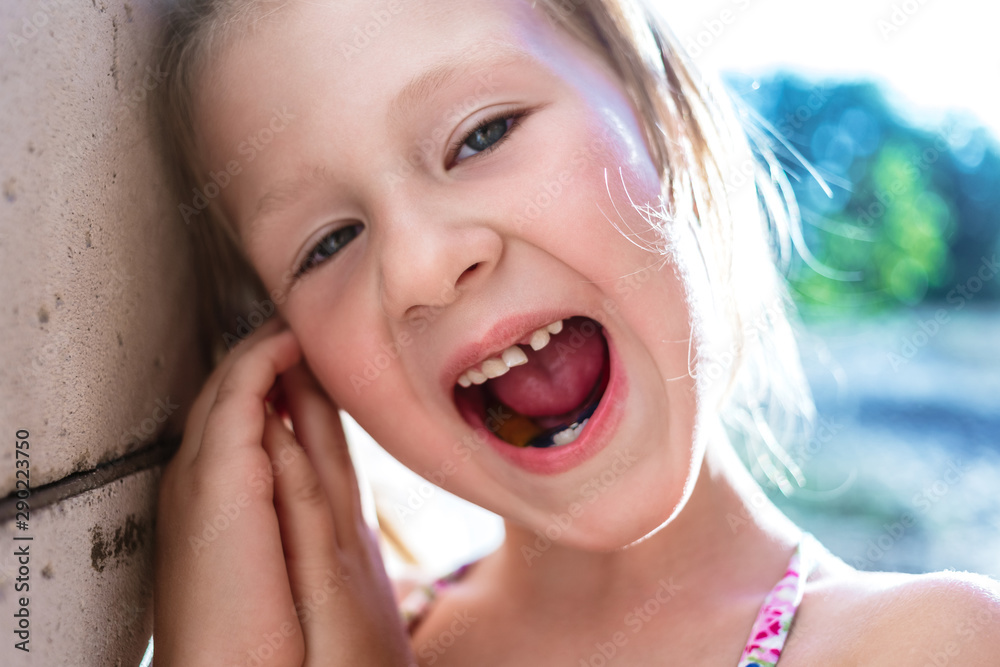 Little girl with crooked teeth and orthodontic appliance. Little girl with crooked teeth and orthodontic appliance.