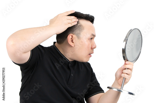 Portrait of serious young Asian bald man with alopecia, checking hairline while looking at the mirror isolated on white background. Hair loss, hair transplant concept.