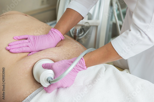 Foto Closeup photo of fat man with big belly having cavitation procedure removing cel