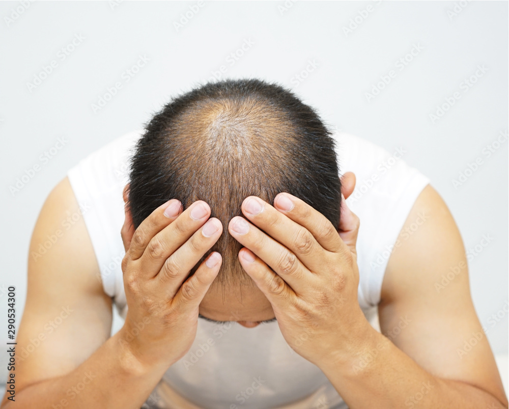Fototapeta premium Stressed man with head in hands at home.