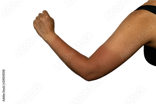 日焼け跡がはっきり残る日本人女性の左腕