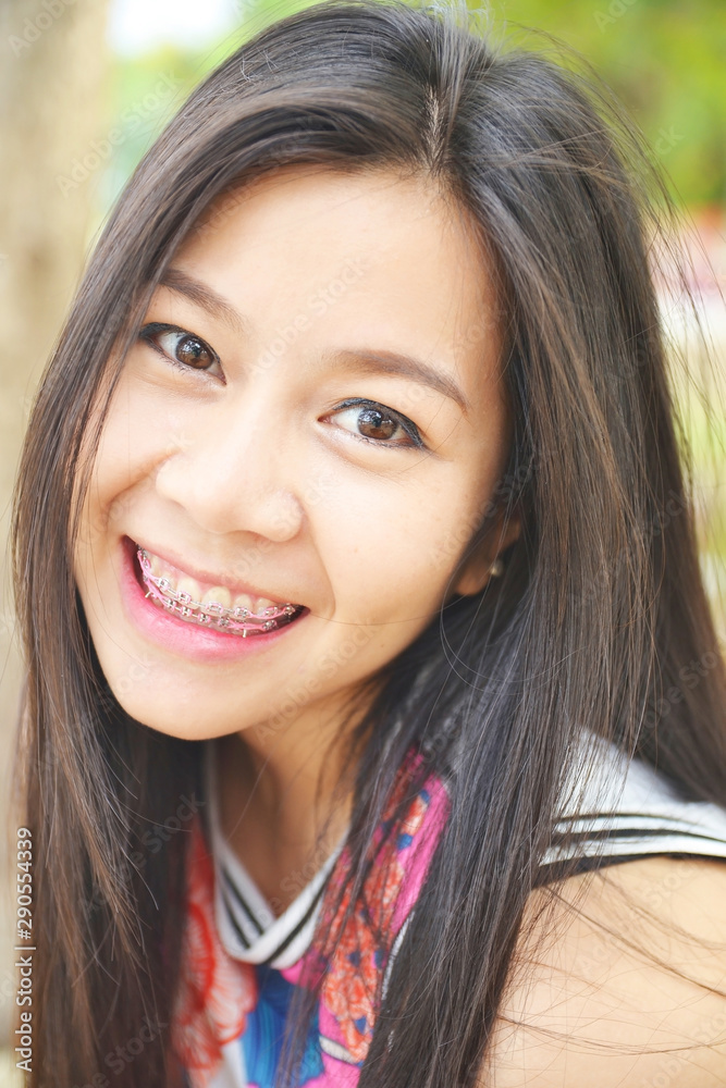 portrait of smiling asian woman with dental braces system portrait of smiling asian woman with dental braces system